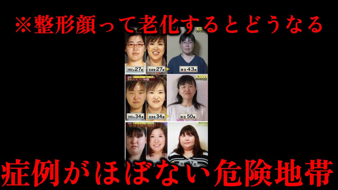 整形した顔は10年後どう変わる？加齢で崩れにくい選択をするための考え方